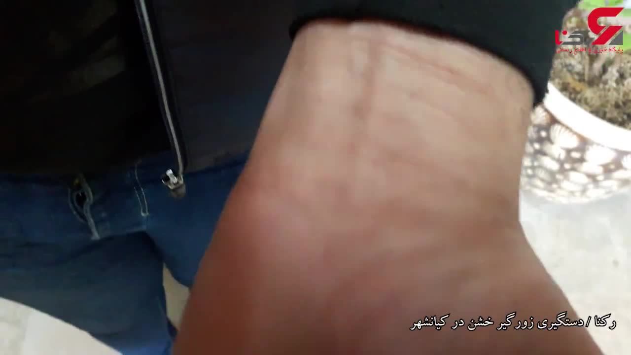 ÙÙØ´Ù ÙØ±Ø¯ ÙØ®ÙÙ Ø¨Ø±Ø§Û Ø²ÙØ§Ù Ú©ÛØ§ÙØ´ÙØ± ÙÛÙÙ لکه های قرمز با حاشیه مشخص روی آلت مرد و زن. ÙÙØ´Ù ÙØ±Ø¯ ÙØ®ÙÙ Ø¨Ø±Ø§Û Ø²ÙØ§Ù Ú©ÛØ§ÙØ´ÙØ± ÙÛÙÙ