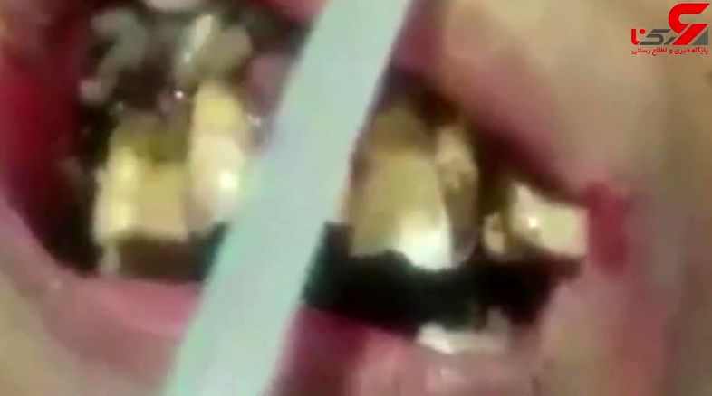 زشت ترین صحنه ای که یک دندانپزشک با آن روبرو شد فیلم 14